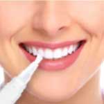 Private Label Teeth Whitening Pen Supplier