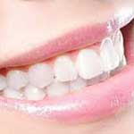 Tooth Mousse Supplier by HCP Wellness